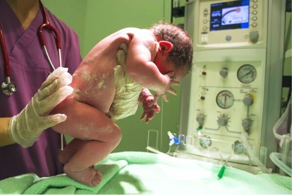 مهاجرت پرستاران - نمایی از نوزاد تازه متولد شده در بیمارستان در دستان پرستار